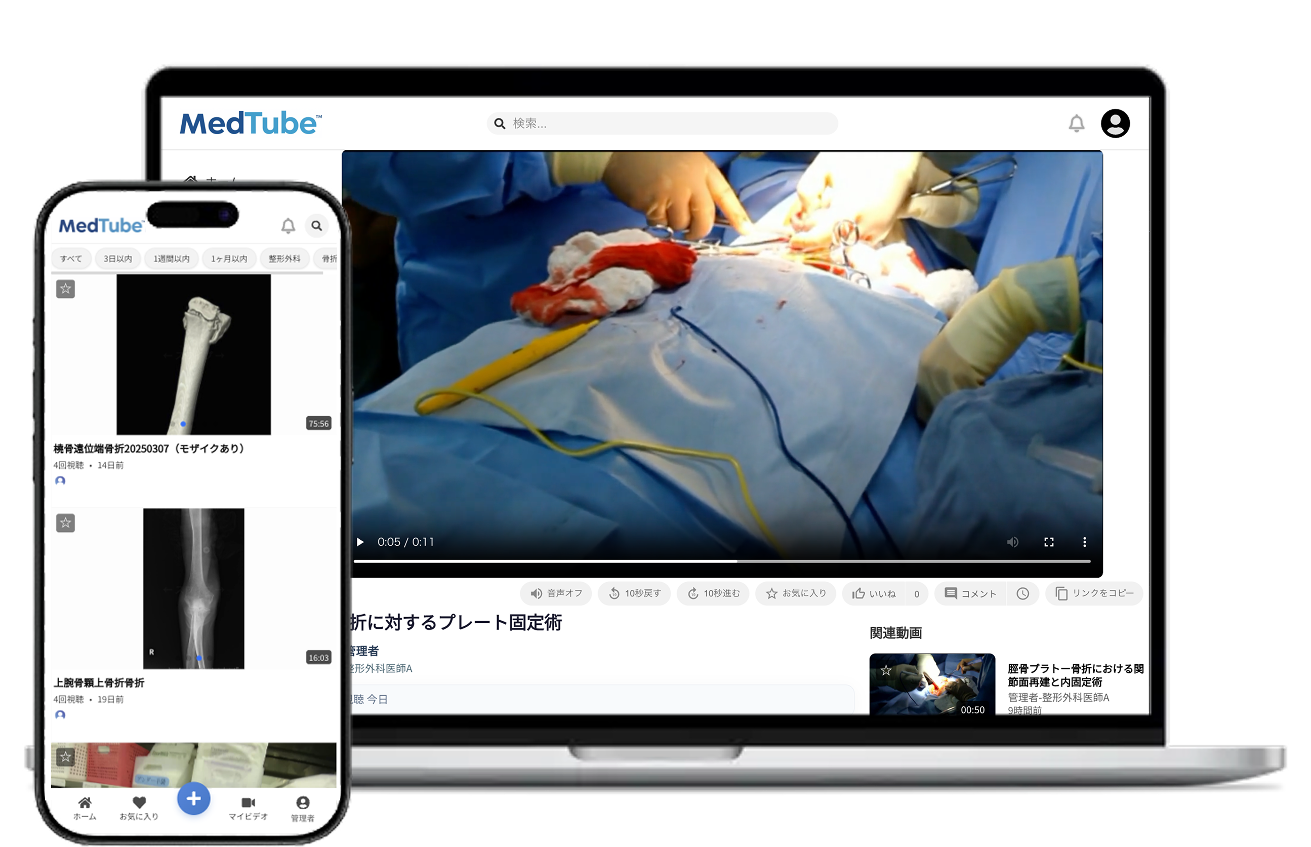 MedTubeインターフェース画面